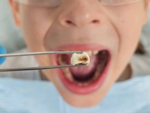 Best Weekend Emergency Dentist in Rossville, GA